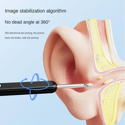 Revolutionary Visual Ear Wax Cleaner with 5M Camera - Safe and Effective Ear Cleaning Tool